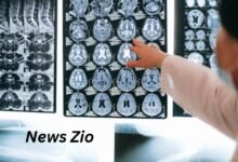 doctorhub360.com neurological diseases