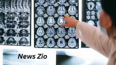 doctorhub360.com neurological diseases